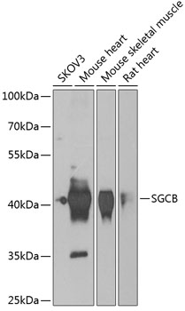 Western blot - SGCB Polyclonal Antibody 