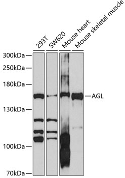 Western blot - AGL Polyclonal Antibody 