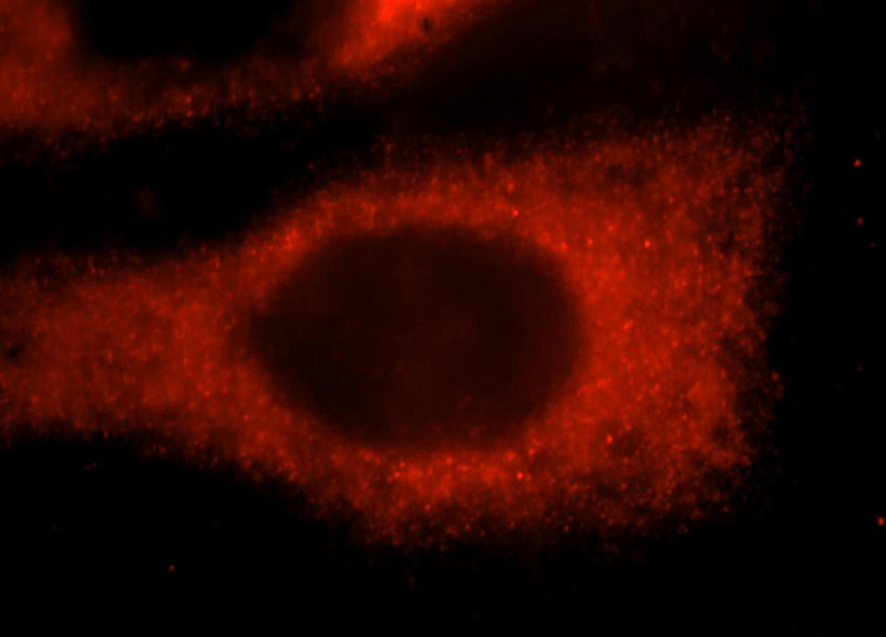 Immunofluorescent analysis of Hela cells, using PGS1 antibody Catalog No:113795 at 1:25 dilution and Rhodamine-labeled goat anti-rabbit IgG (red).