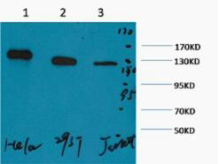 Western blot analysis of 1) Hela, 2) 293T, 3) Jurkat, diluted at 1:2000. cells nucleus extracted by Minute TM Cytoplasmic and Nuclear Fractionation kit (SC-003,Inventbiotech,MN,USA).