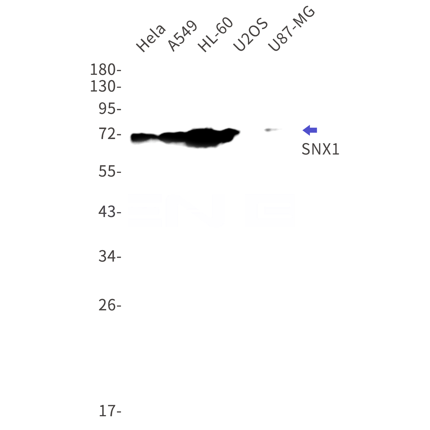 Western blot detection of SNX1 in Hela,A549,HL-60,U2OS,U87-MG cell lysates using SNX1 Rabbit mAb(1:1000 diluted).Predicted band size:59kDa.Observed band size:70kDa.