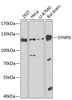 Western blot - SYNPO Polyclonal Antibody 