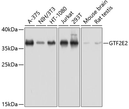 Western blot - GTF2E2 Polyclonal Antibody 
