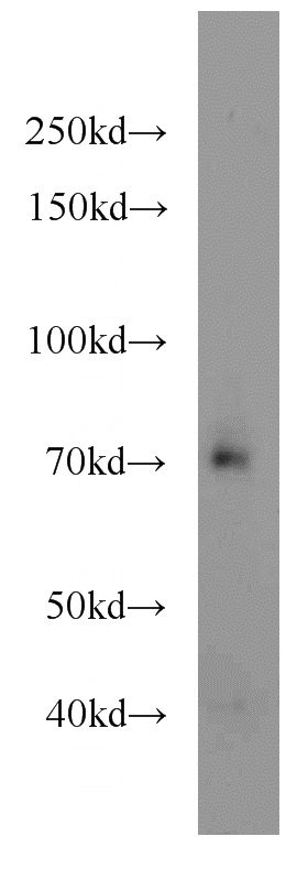 mouse liver tissue were subjected to SDS PAGE followed by western blot with Catalog No:115908(TCF7L2 antibody) at dilution of 1:1000