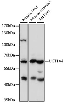 Western blot - UGT1A4 Polyclonal Antibody 