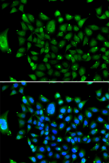 Immunofluorescence - NCOR1 Polyclonal Antibody 