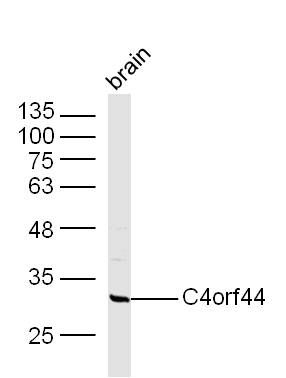 Fig1: Sample: Brain (Mouse) Lysate at 40 ug; Primary: Anti-C4orf44 at 1/300 dilution; Secondary: IRDye800CW Goat Anti-Rabbit IgG at 1/20000 dilution; Predicted band size: 32 kD; Observed band size: 32 kD