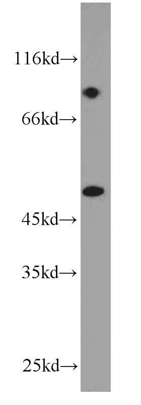 A431 cells were subjected to SDS PAGE followed by western blot with Catalog No:109799(KRT18 antibody) at dilution of 1:1000