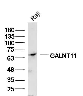 Fig1: Sample:Raji(human) Cell Lysate at 40 ug; Primary: Anti-GALNT11 at 1/300 dilution; Secondary: IRDye800CW Goat Anti-Rabbit IgG at 1/20000 dilution; Predicted band size: 69kD; Observed band size: 69kD