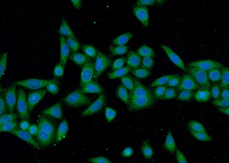Immunofluorescent analysis of HeLa cells using Catalog No:108081(ANKRD55 Antibody) at dilution of 1:50 and Alexa Fluor 488-congugated AffiniPure Goat Anti-Rabbit IgG(H+L)