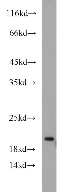 HeLa cells were subjected to SDS PAGE followed by western blot with Catalog No:115609(SSR4 antibody) at dilution of 1:500