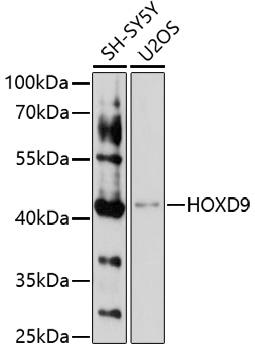 Western blot - HOXD9 Polyclonal Antibody 