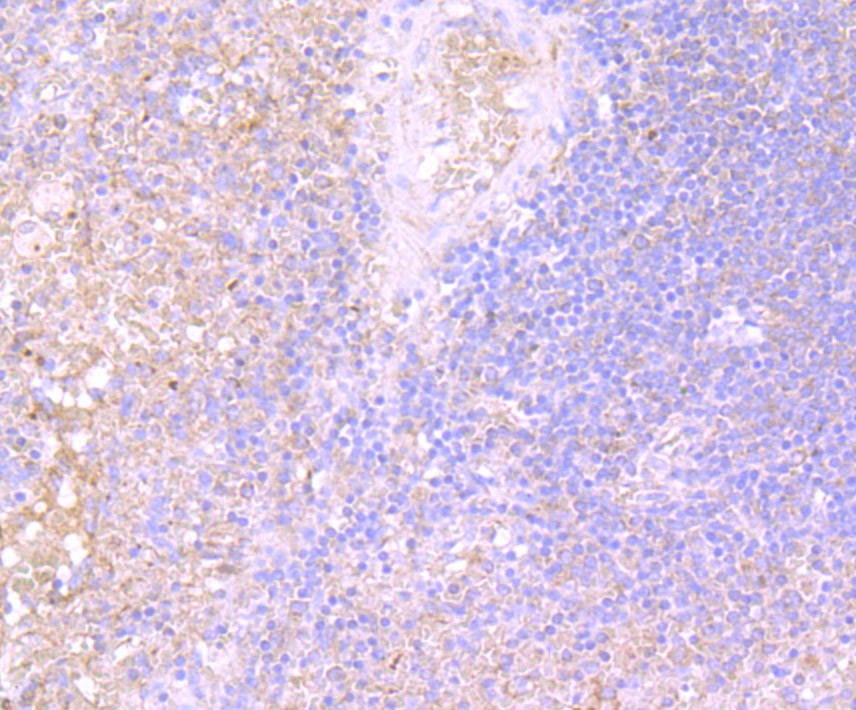 Fig6: Immunohistochemical analysis of paraffin-embedded human spleen tissue using anti-IL-31 antibody. Counter stained with hematoxylin.