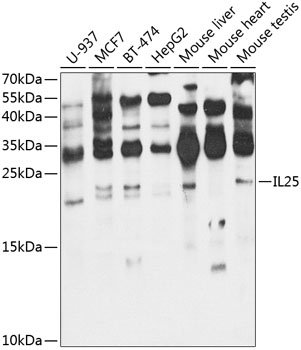 Western blot - IL25 Polyclonal Antibody 
