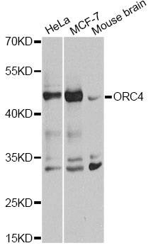 Western blot - ORC4L Polyclonal Antibody 