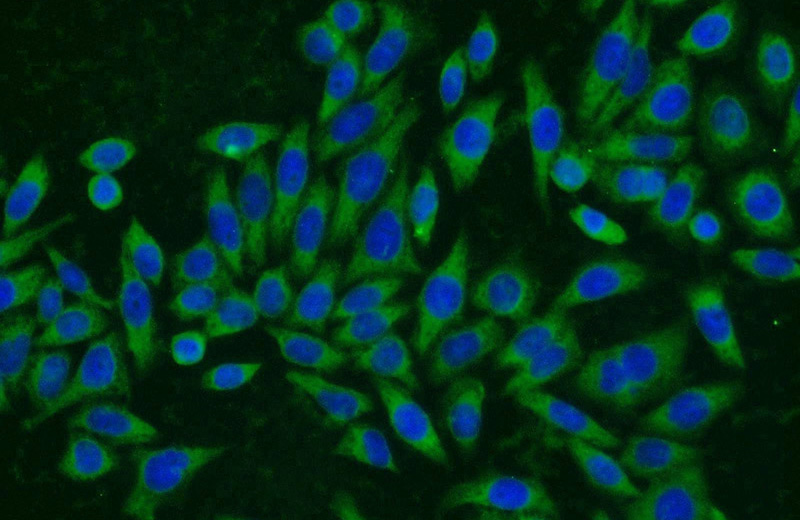 Immunofluorescent analysis of HeLa cells using Catalog No:112711(UBE2V2 Antibody) at dilution of 1:25 and Alexa Fluor 594-congugated AffiniPure Goat Anti-Rabbit IgG(H+L)