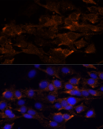 Immunofluorescence - RIPK1 Polyclonal Antibody 