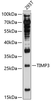 Western blot - TIMP3 Polyclonal Antibody 