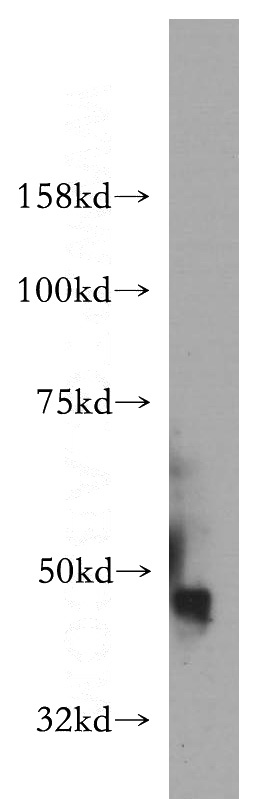 human brain tissue were subjected to SDS PAGE followed by western blot with Catalog No:111633(IGSF11 antibody) at dilution of 1:500
