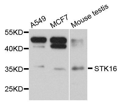 Western blot - STK16 Polyclonal Antibody 