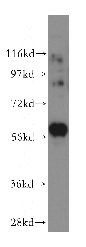 K-562 cells were subjected to SDS PAGE followed by western blot with Catalog No:113857(PKLR antibody) at dilution of 1:500