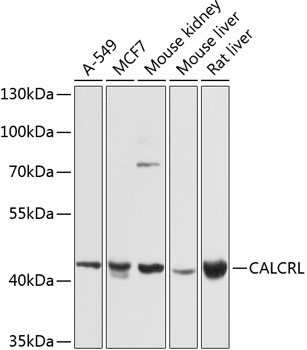 Western blot - CALCRL Polyclonal Antibody 