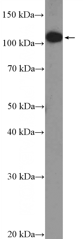 SKOV-3 cells were subjected to SDS PAGE followed by western blot with Catalog No:109888(DENND1A Antibody) at dilution of 1:600