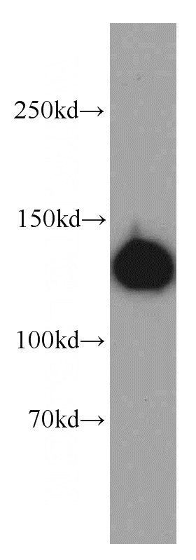 HepG2 cells were subjected to SDS PAGE followed by western blot with Catalog No:112325(LRPPRC antibody) at dilution of 1:500