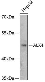 Western blot - ALX4 Polyclonal Antibody 