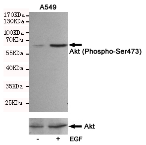 Western blot analysis of extracts from A549 cells, untreated or treated with EGF(10ng/ml,10min), using Akt (Phospho-Ser473) Rabbit pAb (167146,1:500 diluted upper) and AKT(pan) Mouse mAb (200323,lower).