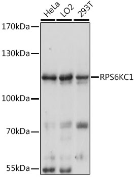 Western blot - RPS6KC1 Polyclonal Antibody 