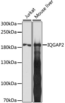 Western blot - IQGAP2 Polyclonal Antibody 