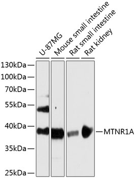 Western blot - MTNR1A Polyclonal Antibody 