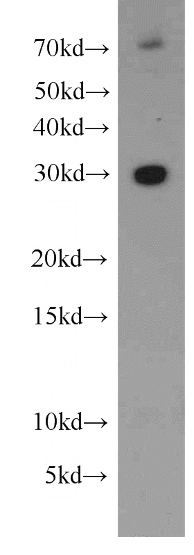 L02 cells were subjected to SDS PAGE followed by western blot with Catalog No:113404(NUBP2 antibody) at dilution of 1:500