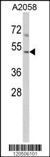 Western blot analysis of ACTR3 Antibody (C-term) (Cat. #169115) in A2058 cell line lysates (35ug/lane). ACTR3 (arrow) was detected using the purified Pab.