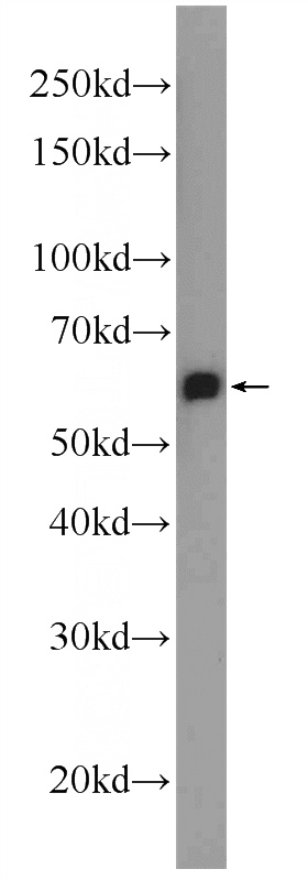 mouse brain tissue were subjected to SDS PAGE followed by western blot with Catalog No:108782(C6orf182 Antibody) at dilution of 1:600