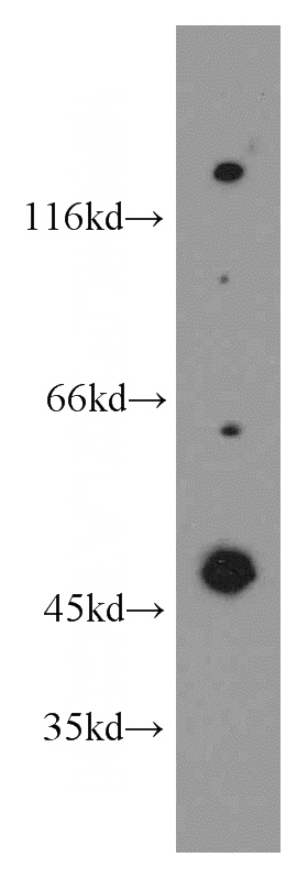 HT-1080 cells were subjected to SDS PAGE followed by western blot with Catalog No:115191(SH3D19 antibody) at dilution of 1:500