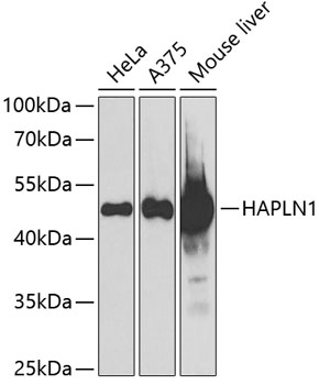 Western blot - HAPLN1 Polyclonal Antibody 