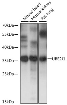 Western blot - UBE2J1 Polyclonal Antibody 