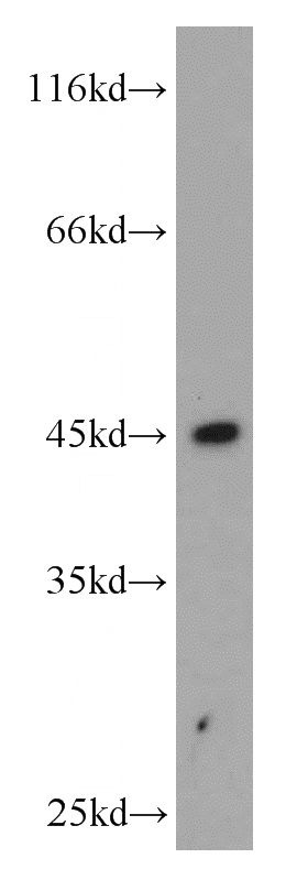 human placenta tissue were subjected to SDS PAGE followed by western blot with Catalog No:111430(HLA-F antibody) at dilution of 1:500