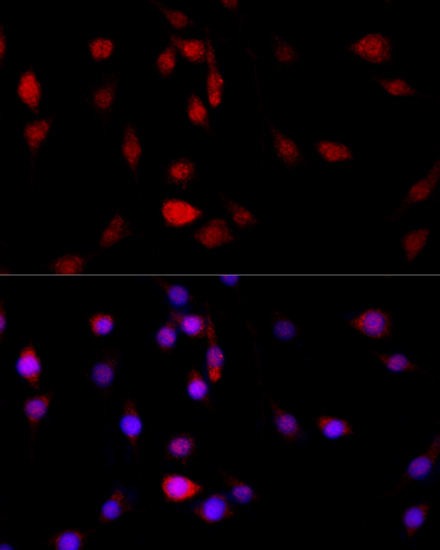 Immunofluorescence - FLNB Polyclonal Antibody 