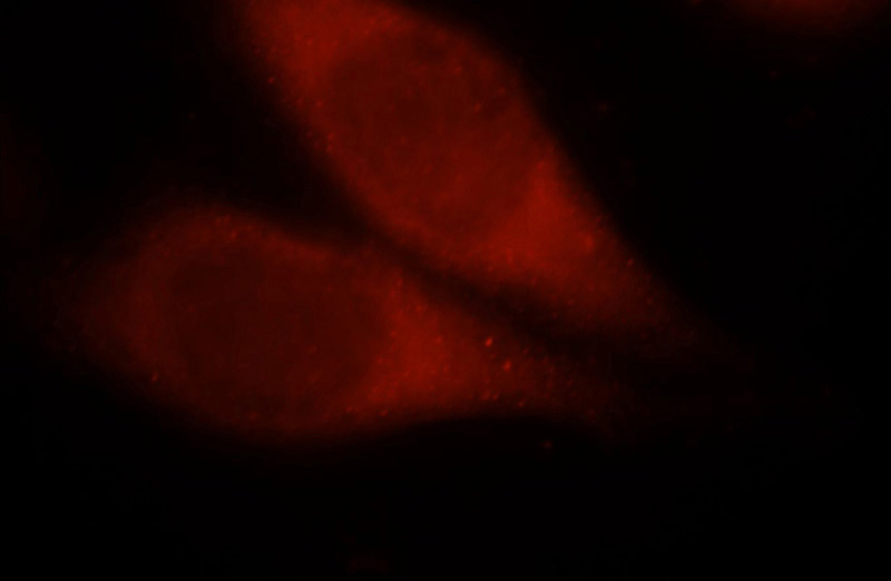 Immunofluorescent analysis of Hela cells, using PCDHGB3 antibody Catalog No:113701 at 1:25 dilution and Rhodamine-labeled goat anti-rabbit IgG (red).