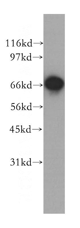 MCF7 cells were subjected to SDS PAGE followed by western blot with Catalog No:111176(GSPT2 antibody) at dilution of 1:500