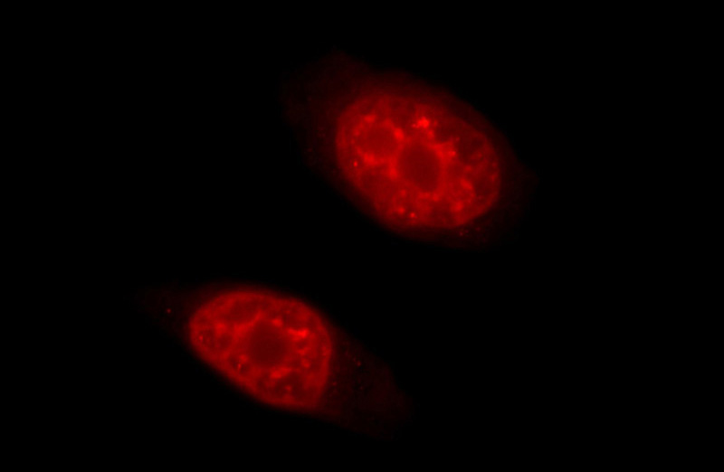 Immunofluorescent analysis of HeLa cells using Catalog No:116047(THoc2 Antibody) at dilution of 1:50 and Rhodamine-Goat anti-Rabbit IgG