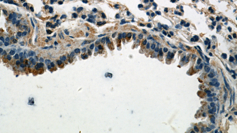 Immunohistochemical of paraffin-embedded mouse lung using Catalog No:108881(CASP9 antibody) at dilution of 1:25 (under 40x lens)