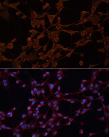 Immunofluorescence - P Glycoprotein Polyclonal Antibody 