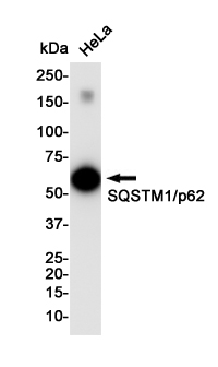 Western blot detection of SQSTM1/p62 in Hela cell lysates using SQSTM1/p62 Rabbit pAb(1:1000 diluted).Predicted band size:48KDa.Observed band size:62KDa.