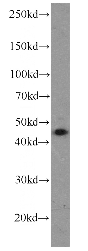 mouse liver tissue were subjected to SDS PAGE followed by western blot with Catalog No:110122(DUSP9 antibody) at dilution of 1:500