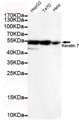 Western blot detection of Keratin 7(C-terminus) in T47D,Hela and HepG2 cell lysates using Keratin 7(C-terminus) mouse mAb (1:1000 diluted).Predicted band size: 55KDa,Observed band size: 55KDa.