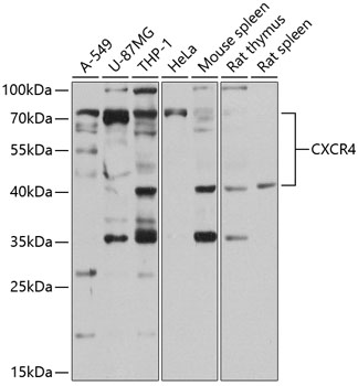 Western blot - CXCR4 Polyclonal Antibody 